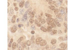 Immunohistochemistry (IHC) image for anti-Cullin 2 (CUL2) (AA 150-200) antibody (ABIN7448503) (Cullin 2 anticorps  (AA 150-200))