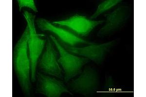 Immunofluorescence of monoclonal antibody to MAD2L1BP on HeLa cell.