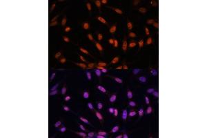 Immunofluorescence analysis of NIH/3T3 cells using Twist antibody (ABIN6128846, ABIN6149715, ABIN6149718 and ABIN6223153) at dilution of 1:100. (TWIST1 anticorps  (AA 103-202))