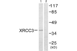 Western blot analysis of extracts from HepG2 cells, treated with Adriamycin (0. (XRCC3 anticorps  (Internal Region))