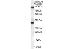 Image no. 1 for anti-LIM Domain Binding 3 (LDB3) (Internal Region) antibody (ABIN374603) (LIM Domain Binding 3 Protein anticorps  (Internal Region))