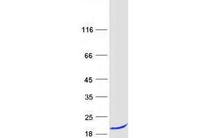 Validation with Western Blot