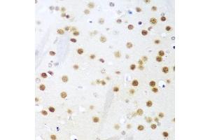 Immunohistochemistry of paraffin-embedded mouse brain using UNG antibody (ABIN6133476, ABIN6149934, ABIN6149936 and ABIN6216305) at dilution of 1:100 (40x lens). (UNG anticorps  (AA 1-313))