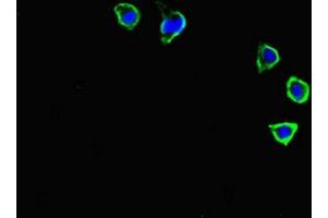 Immunofluorescence staining of HepG2 cells with ABIN7146103 at 1:400, counter-stained with DAPI. (CXCR3 anticorps  (AA 4-50))
