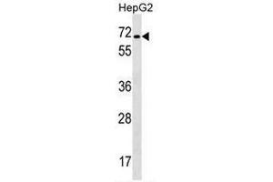 CACNB1 Antibody (C-term) western blot analysis in HepG2 cell line lysates (35µg/lane). (CACNB1 anticorps  (C-Term))
