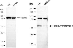 Western blotting analysis using arginyltransferase 1 antibody (ABIN7797649).