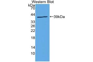 Detection of Recombinant DAT, Human using Polyclonal Antibody to Dopamine Transporter (DAT)