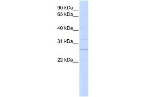 TMEM126B antibody used at 1 ug/ml to detect target protein. (TMEM126B anticorps  (N-Term))