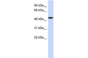 WB Suggested Anti-SGMS2 Antibody Titration: 0. (Sphingomyelin Synthase 2 anticorps  (N-Term))