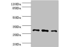 Western blot All lanes: NNMT antibody at 2. (NNMT anticorps  (AA 1-264))