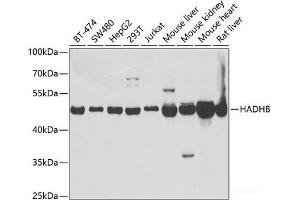 Western blot analysis of extracts of various cell lines using HADHB Polyclonal Antibody at dilution of 1:1000.