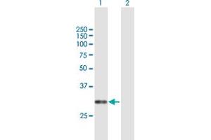 Western Blot analysis of CACNG6 expression in transfected 293T cell line by CACNG6 MaxPab polyclonal antibody. (CACNG6 anticorps  (AA 1-260))
