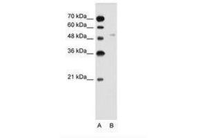 Image no. 2 for anti-Solute Carrier Family 2 (Facilitated Glucose Transporter), Member 6 (SLC2A6) (AA 351-400) antibody (ABIN205018) (SLC2A6 anticorps  (AA 351-400))