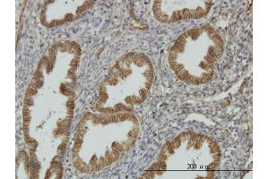 Immunoperoxidase of monoclonal antibody to NDRG1 on formalin-fixed paraffin-embedded human endometrium.