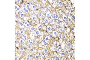 Immunohistochemistry of paraffin-embedded mouse liver using CDH2 antibody at dilution of 1:100 (400x lens). (N-Cadherin anticorps)