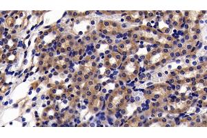 Detection of SIRT5 in Mouse Kidney Tissue using Polyclonal Antibody to Sirtuin 5 (SIRT5)