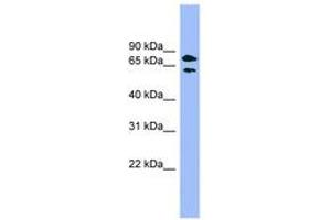 Image no. 1 for anti-Pantothenate Kinase 4 (PANK4) (AA 359-408) antibody (ABIN6744130) (PANK4 anticorps  (AA 359-408))