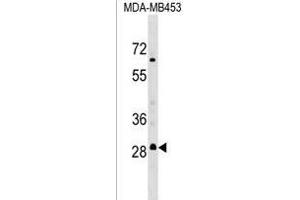 RH3 Antibody (C-term) (ABIN1536881 and ABIN2849415) western blot analysis in MDA-M cell line lysates (35 μg/lane). (MARCH3 anticorps  (C-Term))