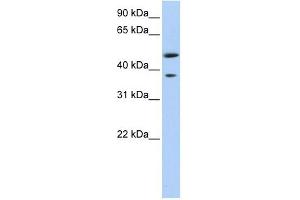 MAGEA3 antibody used at 1 ug/ml to detect target protein. (MAGEA3 anticorps  (Middle Region))