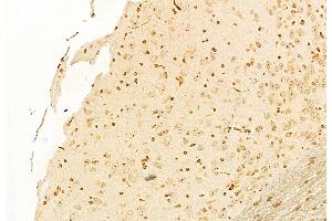 ABIN6262026 and ABIN6278470 at 1/100 staining Mouse brain tissue by IHC-P. (GNRH1 anticorps  (Internal Region))