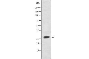 Western blot analysis FRAT1 using Jurkat whole cell lysates (FRAT1 anticorps  (C-Term))