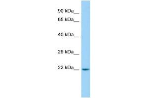 WB Suggested Anti-ARL15 Antibody Titration: 1. (ARL15 anticorps  (C-Term))