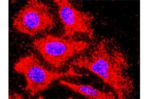 Proximity Ligation Analysis of protein-protein interactions between INHBB and ACVR1C. (INHBB anticorps  (AA 1-407))