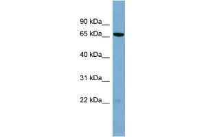 WB Suggested Anti-HP1BP3 Antibody Titration: 0. (HP1BP3 anticorps  (N-Term))