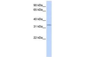 Image no. 1 for anti-SRY (Sex Determining Region Y)-Box 1 (SOX1) (AA 287-336) antibody (ABIN6740273) (SOX1 anticorps  (AA 287-336))
