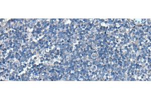 Immunohistochemistry of paraffin-embedded Human tonsil tissue using UFC1 Polyclonal Antibody at dilution of 1:50(x200) (UFC1 anticorps)