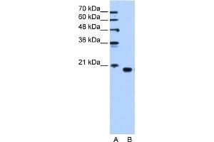 PEBP1 antibody used at 1. (PEBP1 anticorps  (C-Term))