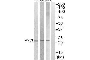 Western Blotting (WB) image for anti-Myosin, Light Chain 3 (MYL3) (Internal Region) antibody (ABIN1852580) (MYL3/CMLC1 anticorps  (Internal Region))