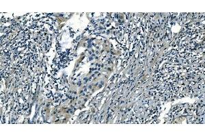IHC analysis of PI-16/PI16 using anti-PI-16/PI16 antibody (ABIN7601074). (PI16 anticorps  (AA 28-363))