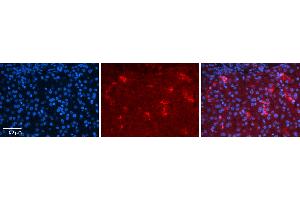 Rabbit Anti-YBX1 Antibody Catalog Number: ARP50946_P050 Formalin Fixed Paraffin Embedded Tissue: Human Liver Tissue Observed Staining: Cytoplasm in Kupffer cells in sinusoids Primary Antibody Concentration: 1:100 Other Working Concentrations: 1:600 Secondary Antibody: Donkey anti-Rabbit-Cy3 Secondary Antibody Concentration: 1:200 Magnification: 20X Exposure Time: 0.