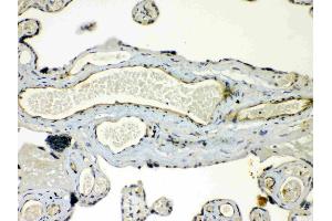 IHC analysis of Connexin 45/GJA7 using anti- Connexin 45/GJA7 antibody .