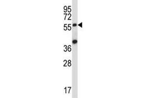 SOCS6 antibody western blot analysis in 293 lysate.