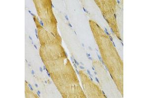 Immunohistochemistry of paraffin-embedded mouse skeletal muscle using PVALB Antibody (ABIN5971476) at dilution of 1/100 (40x lens). (PVALB anticorps)