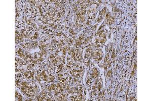 IHC analysis of OAT2/SLC22A7 using anti-OAT2/SLC22A7 antibody (ABIN7601355).
