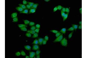 Immunofluorescence staining of Hela cells with ABIN7168176 at 1:66, counter-stained with DAPI. (RPS6KA2 anticorps  (AA 228-395))
