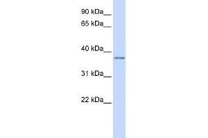 WB Suggested Anti-KCNAB2 Antibody Titration:  0. (KCNAB2 anticorps  (Middle Region))