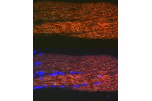 Immunofluorescence analysis of rat bone marrow cells using SERC/ Rabbit mAb (9639) at dilution of 1:100 (40x lens). (ATP2A1/SERCA1 anticorps)