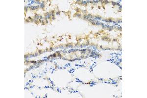 Immunohistochemistry of paraffin-embedded mouse lung using IFNL3 antibody at dilution of 1:100 (40x lens). (IL28B anticorps)