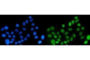 IF analysis of DYNLL1/PIN using anti-DYNLL1/PIN antibody (ABIN6719534).