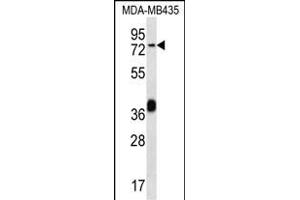 CEL Antibody (Center) (ABIN656486 and ABIN2837867) western blot analysis in MDA-M cell line lysates (35 μg/lane). (Cholesterol Esterase anticorps  (AA 454-482))