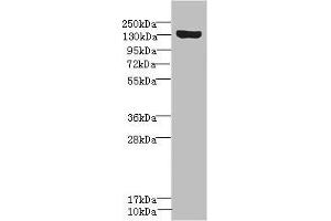 Western blot All lanes: SCN8A antibody IgG at 1. (SCN8A anticorps  (AA 1350-1440))