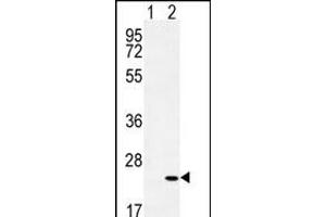 Western blot analysis of CRH (arrow) using rabbit polyclonal CRH Antibody (C-term) (ABIN655191 and ABIN2844807). (CRH anticorps  (C-Term))