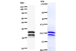 Left: NR4A1staining. (NR4A1 anticorps)