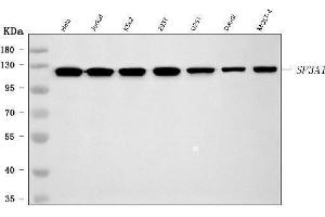 Western blot analysis of SF3A1 using anti-SF3A1 antibody (ABIN7600556). (SF3A1 anticorps  (AA 20-556))