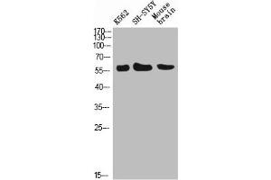 Western Blot analysis of K562 SH-SY5Y mouse-brain cells using E-Selectin Polyclonal Antibody diluted at 1:500. (Selectin E/CD62e anticorps)