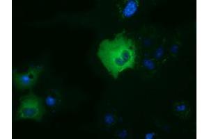 Anti-DYNC1LI1 mouse monoclonal antibody (ABIN2452965) immunofluorescent staining of COS7 cells transiently transfected by pCMV6-ENTRY DYNC1LI1 (RC222010). (DYNC1LI1 anticorps)